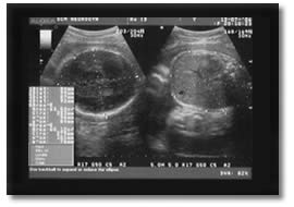 photo echographie 40 SA