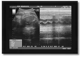photo echographie septieme (8eme) mois de grossesse